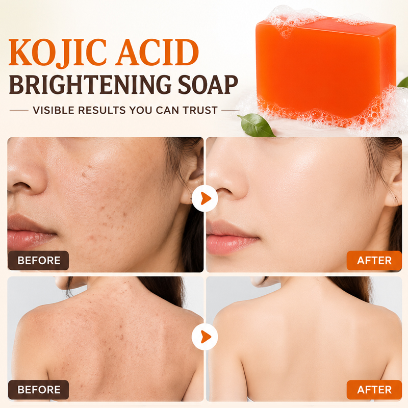 Sabonete de Ácido Kójico, Paco - Kojic Acid Soap avaliação e preço